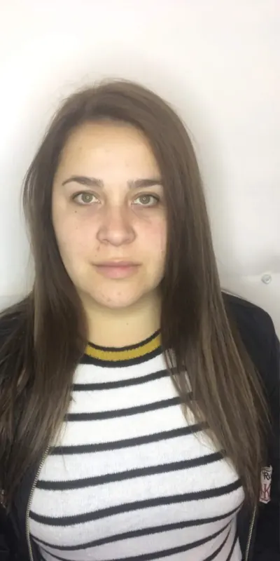 Antes: rostro sin maquillaje